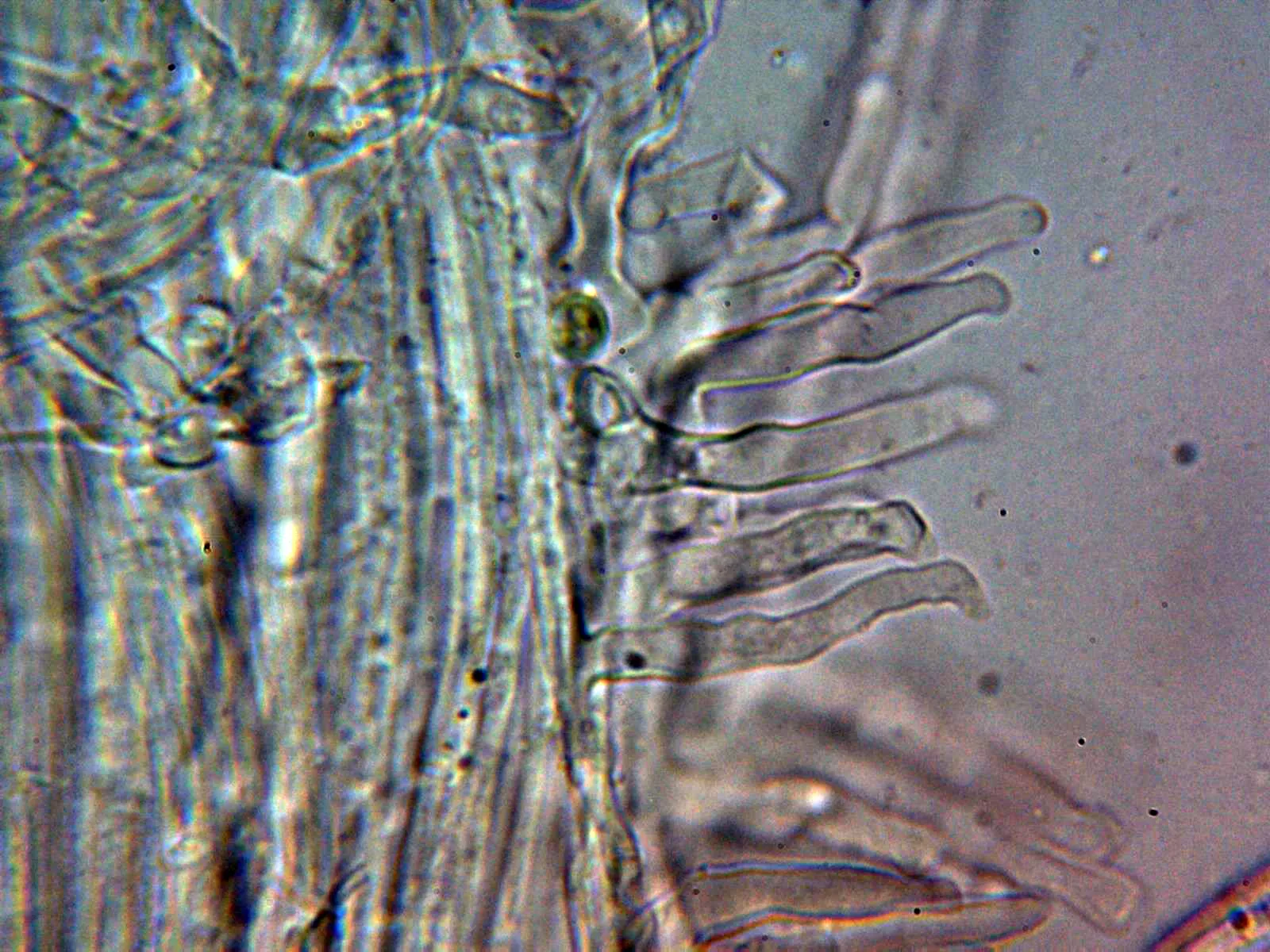 Microscopía de Phloeomana speirea - 10 - Caulocistidios 2